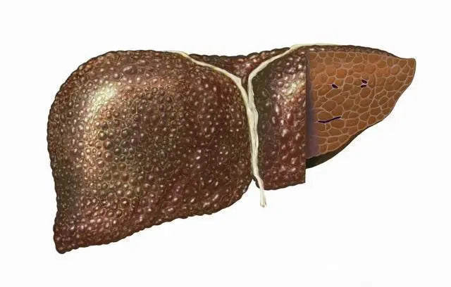 Two cups of coffee a day reduces the risk of liver cancer by 43%