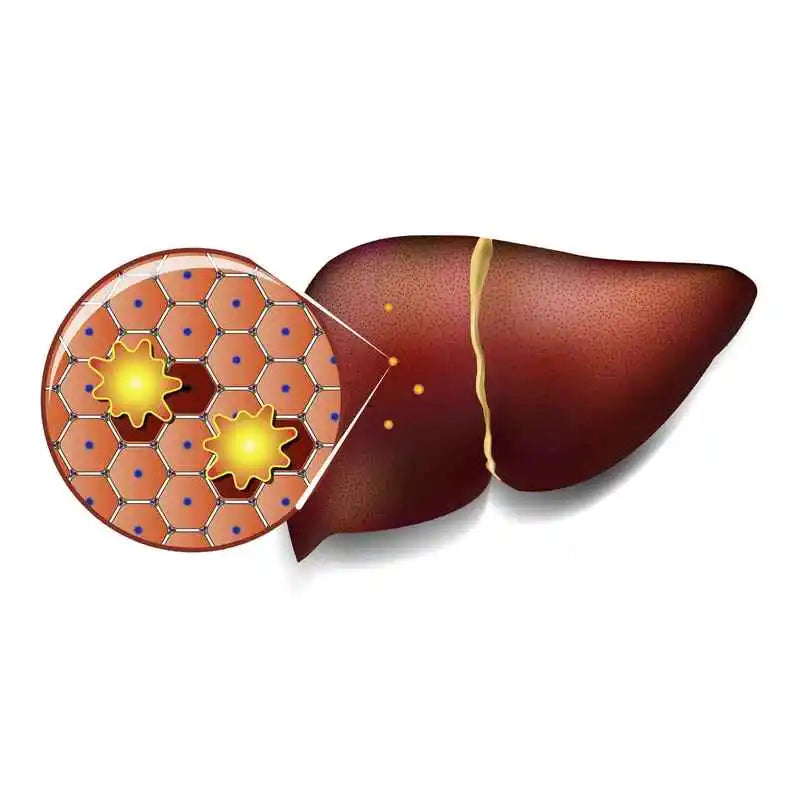 1 drop of blood test liver cancer screening chip is less than 1,000 yuan