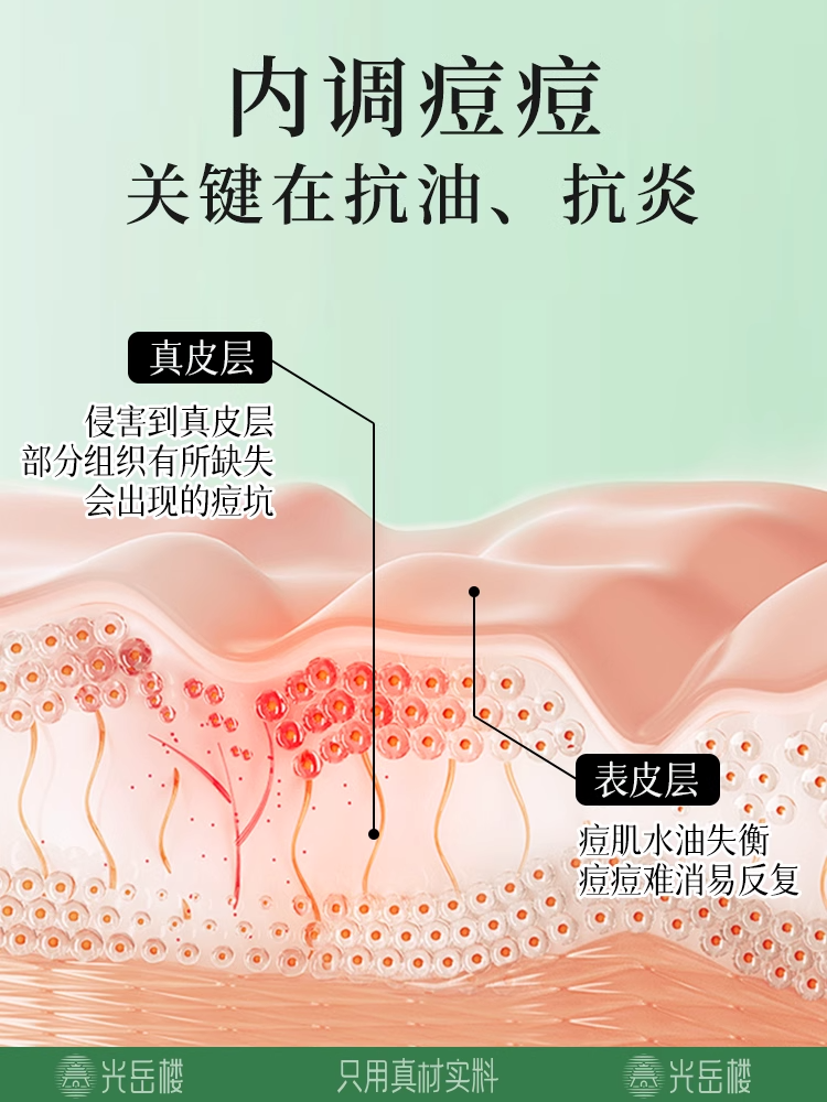 Гормональный чай от прыщей – травяной детокс-чай для очищения