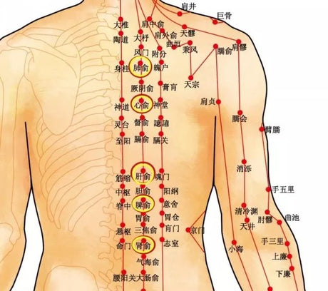 Insomnia, in addition to soaking feet, cupping can also be used