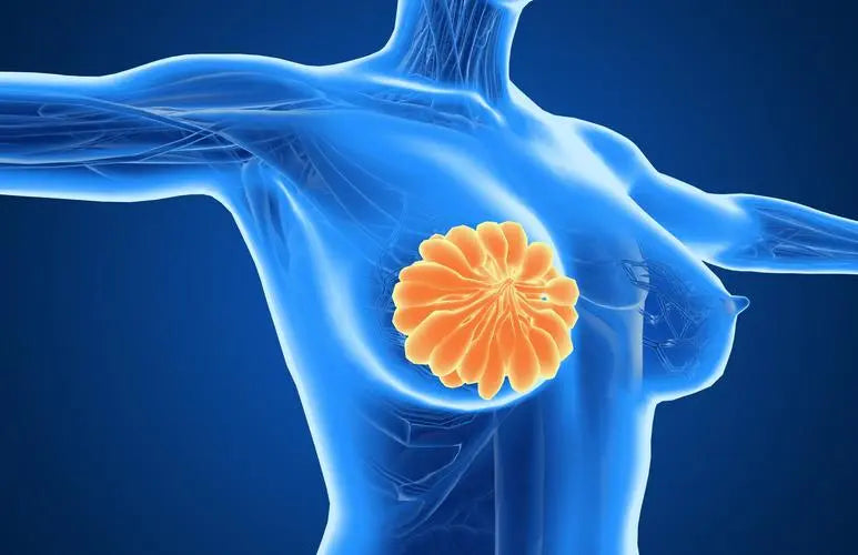 34-year-old female breast cancer turned to lung and then to brain