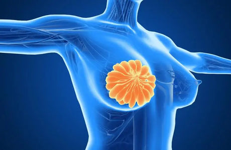 34-year-old female breast cancer turned to lung and then to brain