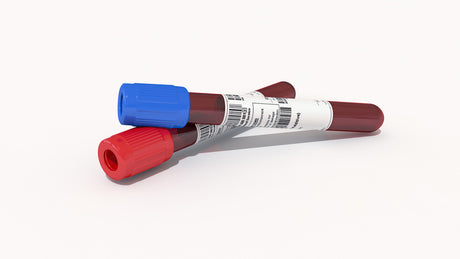 Mastering Blood Sugar Testing 123: Have You Got the Essentials Down?
